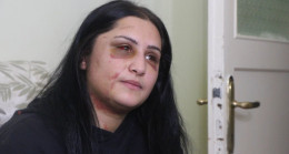 Samsun’da eski eşi tarafında darp edilen Emriye: En ağır şekilde cezalandırılsın